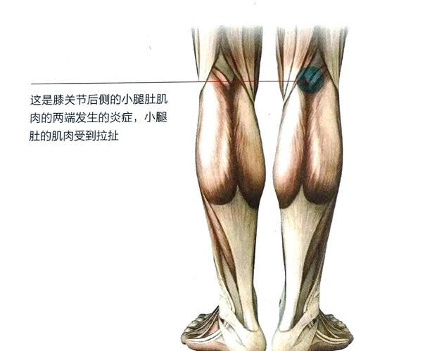 官方：尤文图斯门将平索里奥左腿内侧腓肠肌肌肉损伤